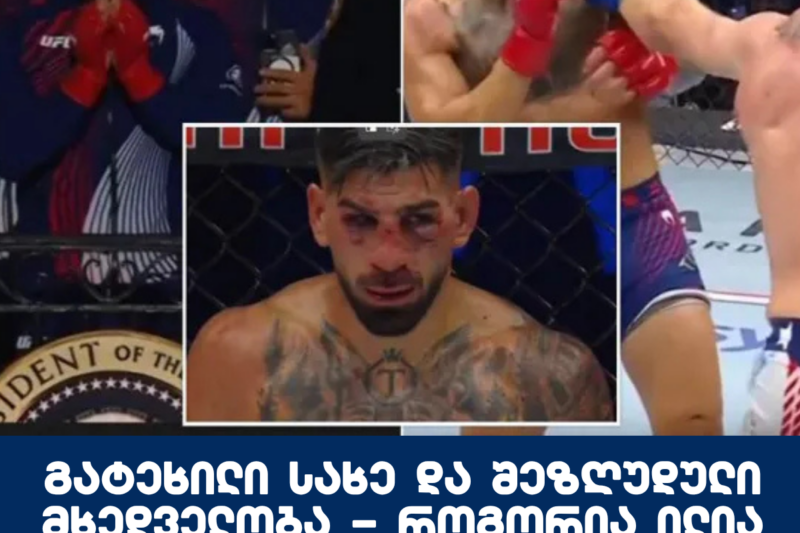 გა­ტე­ხი­ლი სახე და შე­ზღუ­დუ­ლი მხედ­ვე­ლო­ბა – როგორია ილია თოფურიას მდგომარეობა?